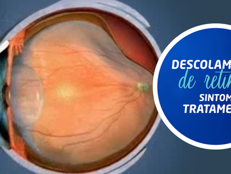 Descolamento de Retina