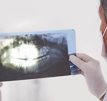 Pröva en X-Ray