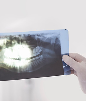 Dentista analisando radiografia