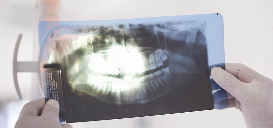 Prüfung eines Röntgen