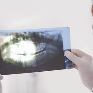 Dental Ankylosis: What It Is, Causes, Symptoms, and Treatment Options