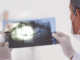 Dicas para alavancar seu negócio de odontologia - Estrutura Física