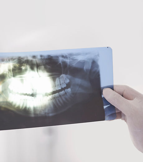 Examining an X-ray