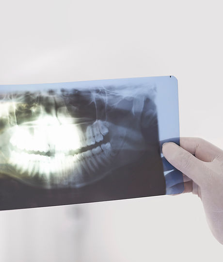 Examining an X-ray
