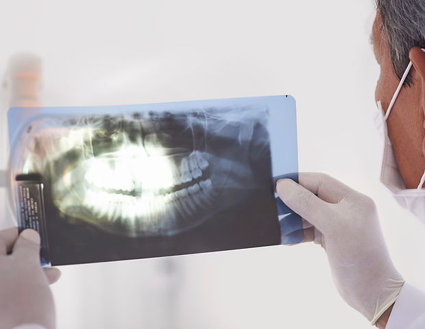 Examining an X-ray