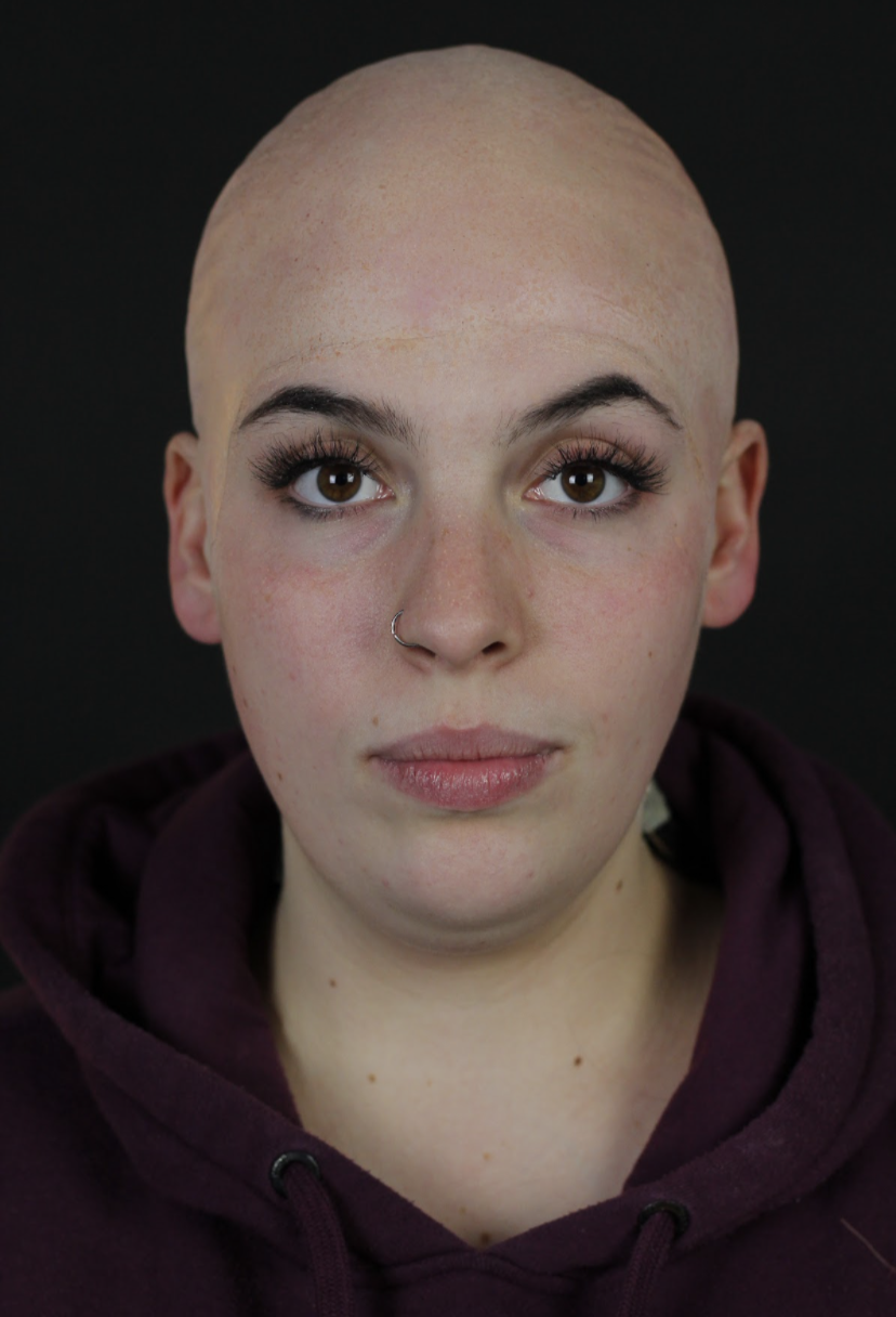 Latex Bald Cap on Isa