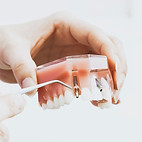 Implant 1_edited.jpg