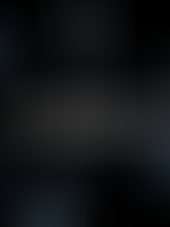 9#Do you know this expression?