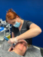 Pro MicroNeedling