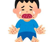 手足口病ってどんな病気?