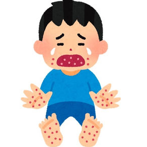 手足口病ってどんな病気？