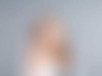 Lo que necesitas saber sobre Invisalign y la caries dental