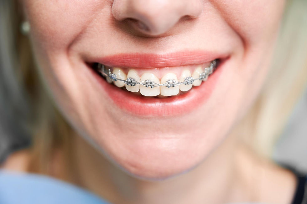Brackets Polanco