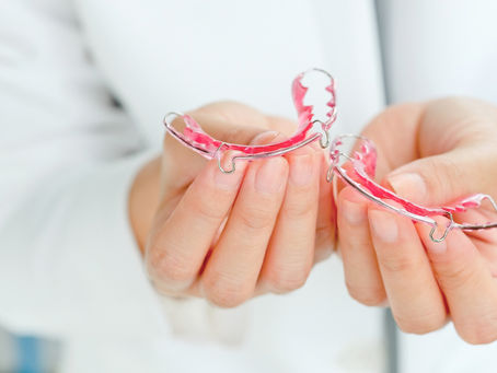 Retenedores Ortodóncicos: El Componente Clave Para Mantener Tu Sonrisa