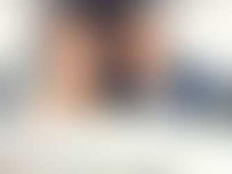 Invisalign: Una Sonrisa Radiante Sin Sacrificar Tu Vida Social