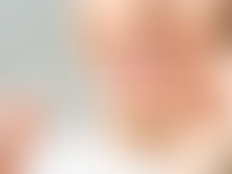 Nuevos Alineadores Spark: Una Solución Innovadora para una Sonrisa Perfecta