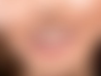 5 Razones Por Las Que La Ortodoncia En México Es Una Opción Asequible