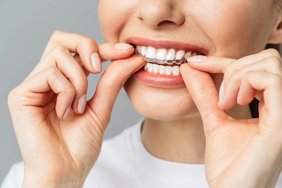 Invisalign Polanco