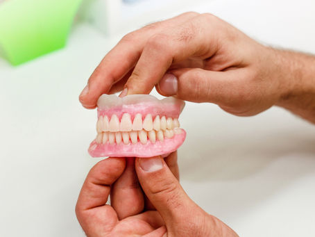 Comparación de implantes vs prótesis removible (placas)