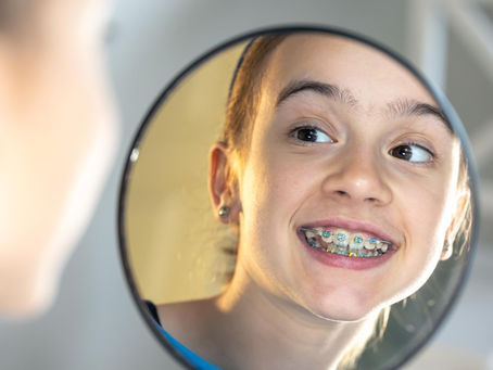 Diferencias entre brackets metálicos y de zafiro