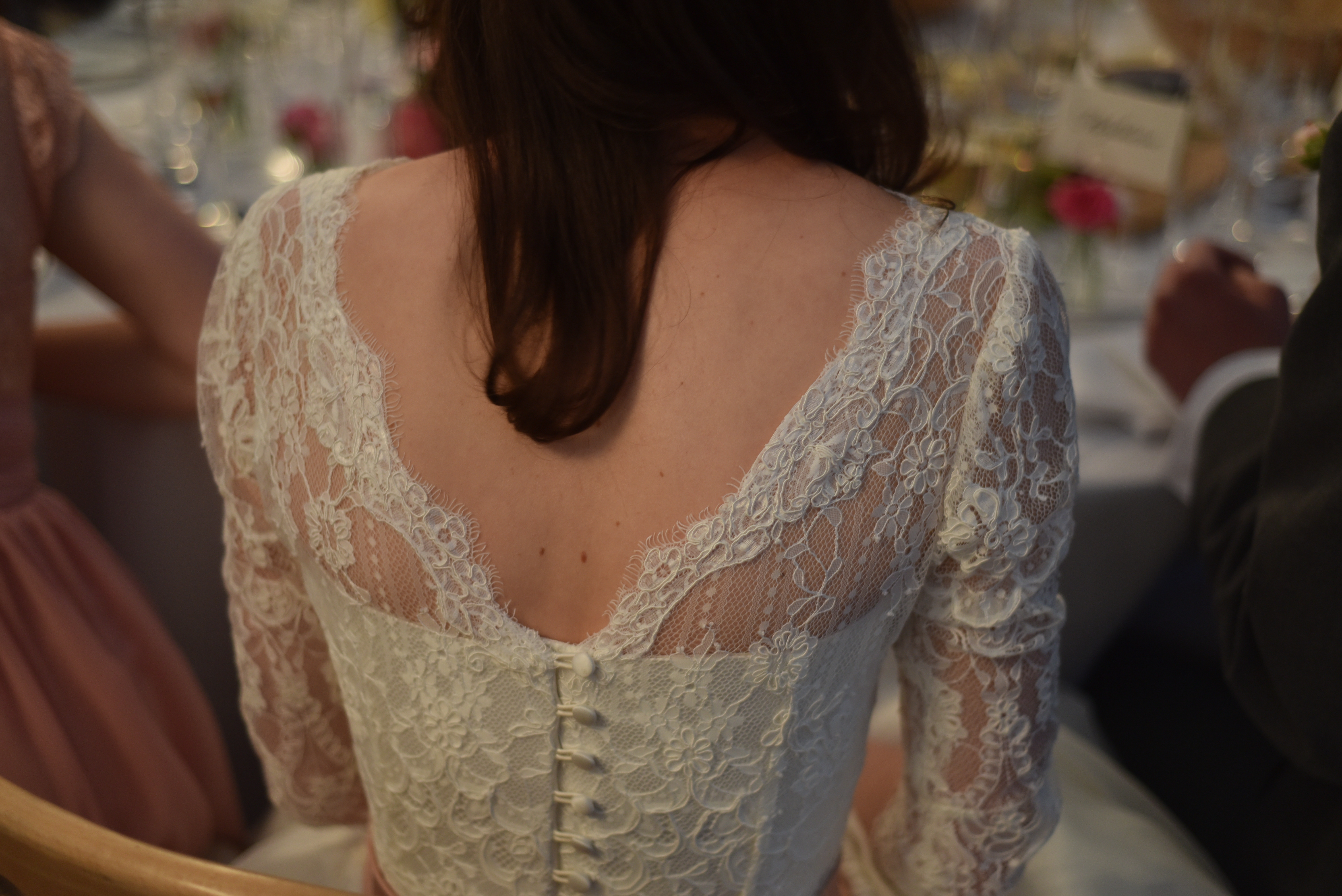 The back detail
