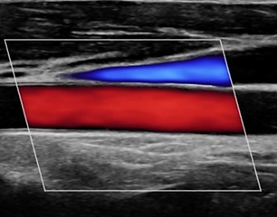 Esonography vascular ultrasound 6 month course