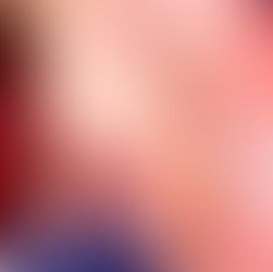 Menor pierde extremidades por explosión de pirotecnia en Pachuca