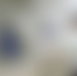 Detección oportuna, factor clave en atención del cáncer de mama