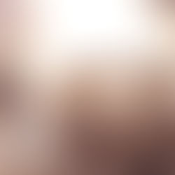 Explotan 2 camionetas con huachicol en San Agustín Tlaxiaca