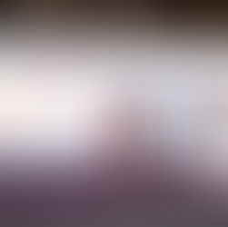 Salud reitera llamado a vacunarse contra sarampión, rubéola y paperas