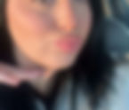 Lip Filler