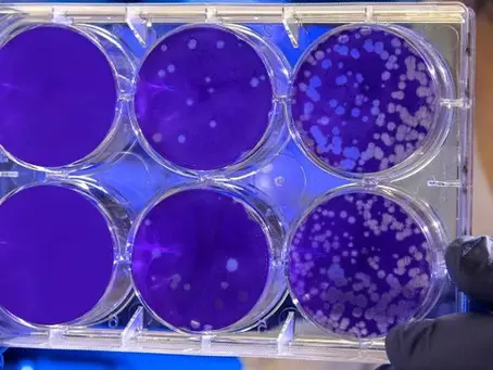 Actualizada la normativa sobre Legionella: Cambios y repercusiones en el mantenimiento de instalaciones