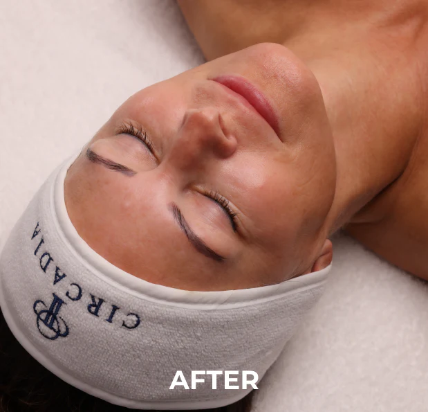 AFTER: Woman with Circadia headband