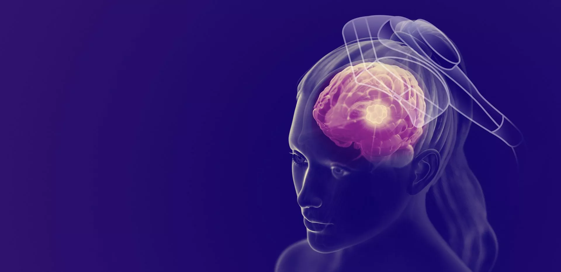 NS-brain-girl-patient-howdoesneurostarworkpage-desktop-banner-1920x931-2-1920x0-c-default.