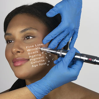 Micro-needle00.jpg