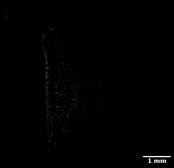 Coeur_KO1_Z1_reg_output_crop.gif