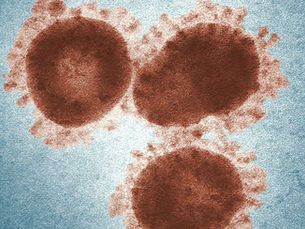 México acumula 4 muertos por sarampión; reportan más de 1,600 casos este 2025