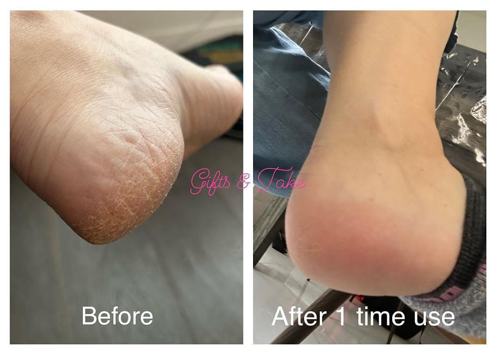 Thumbnail: Lala Luv Foot Balm Set 滑嘟嘟腳踭護理組合套裝