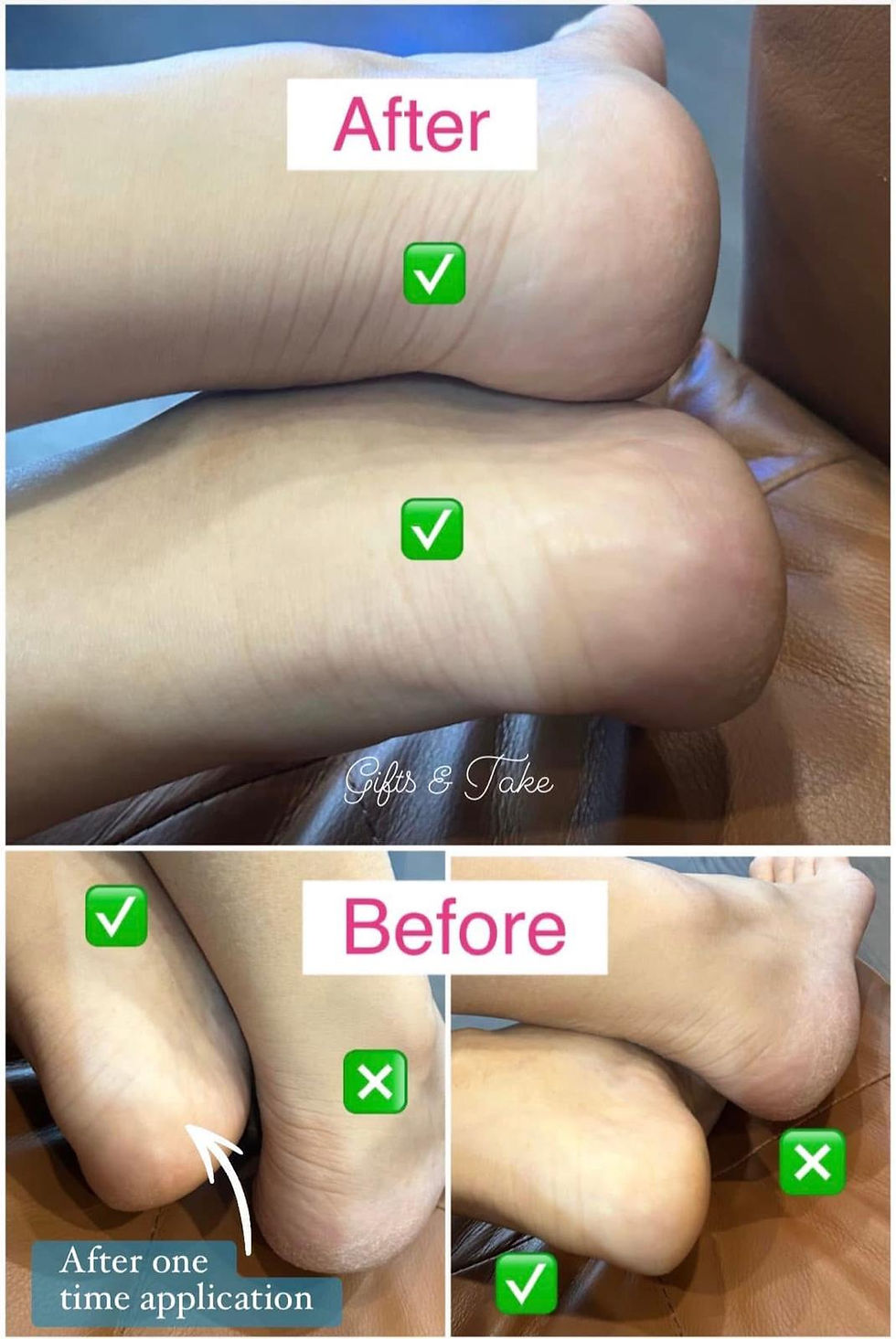 Thumbnail: Lala Luv Foot Balm Set 滑嘟嘟腳踭護理組合套裝