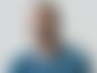 What is scalp micro pigmentation