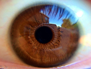 ¿Sufres el síndrome del ojo seco?