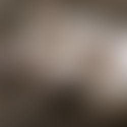 Is It Ethical to Grow Human Organs in Pigs?