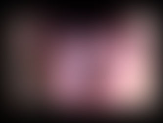 Bulbar & Pseudobulbar Palsy: Causes, Symptoms & Physiotherapy Management at Physio360.