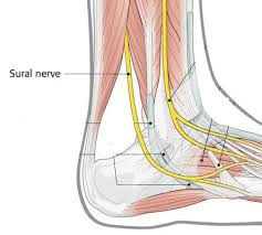 Sural Nerve Pain – Causes, Symptoms & Best Physiotherapy Treatment at Physio360.