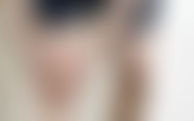 Conservative ACL Management: A Non-Surgical Approach to Recovery.