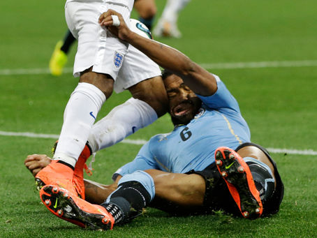 HEAD INJURY IN FOOTBALL PLAYERS.