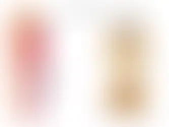 Understanding Sciatica and Chiropractic Care for Discomfort Relief