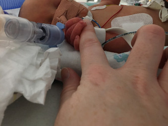 PPROM at 21 weeks - my story of hope by Kerry