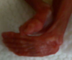 Sinead's baby feet