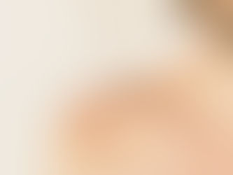 A man with a scar on his shoulder.